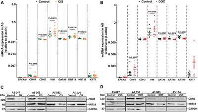 EM-transcriptomic signature predicts drug response in advanced stages of high-grade serous ovarian carcinoma based on ascites-derived primary cultures